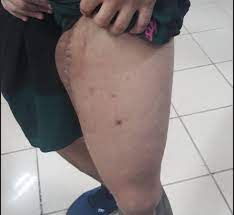 Dívida de R$ 30 motivou tentativa de homicídio na zona leste de São José