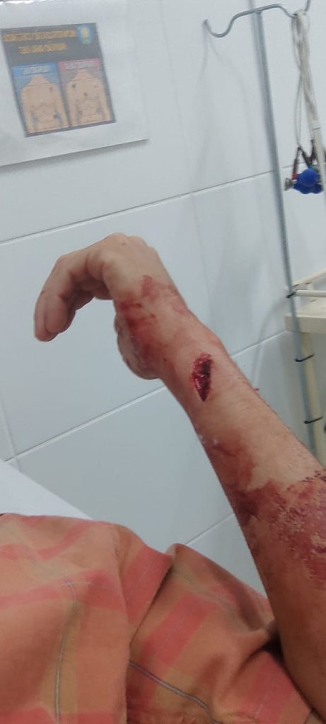 Motorista de aplicativo reage a assalto e fica ferido no Campo dos Alemães