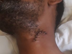 Preso homem que esfaqueou e quase matou por dívida de R$ 8,00