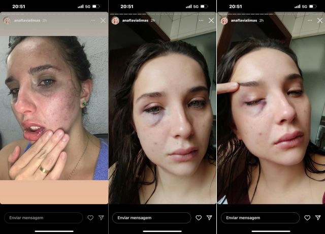 Mulher denuncia agressões de marido e pede ajuda nas redes sociais