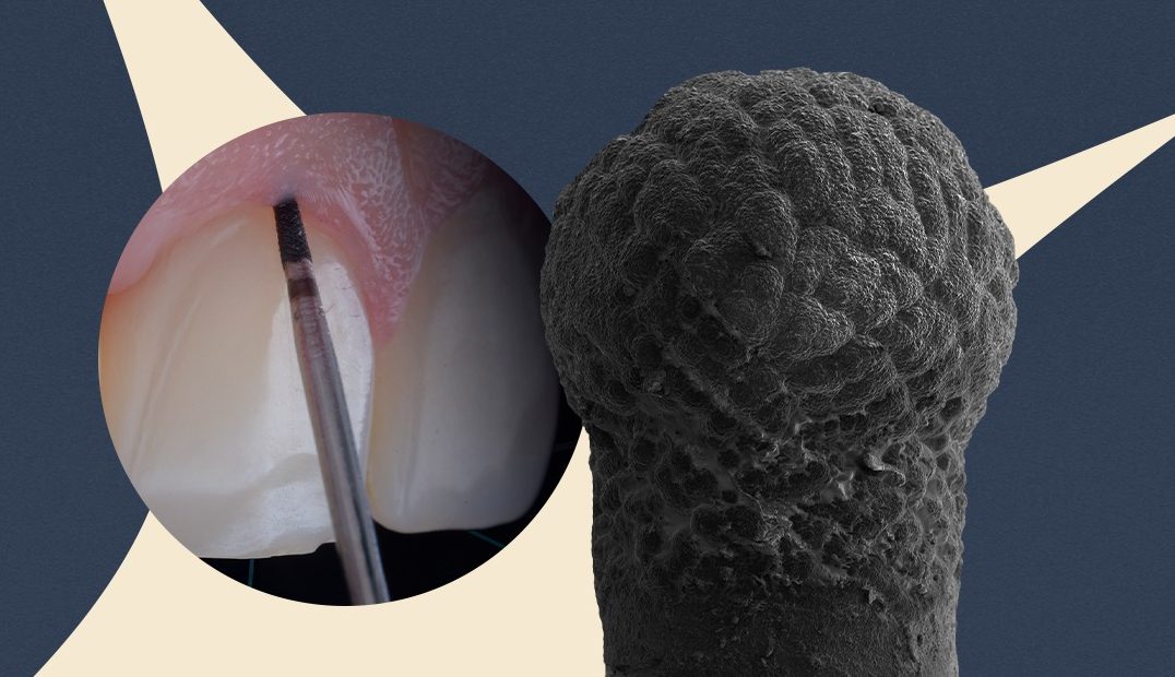 Empresa de São José dos Campos apresenta tecnologia odontológica silenciosa