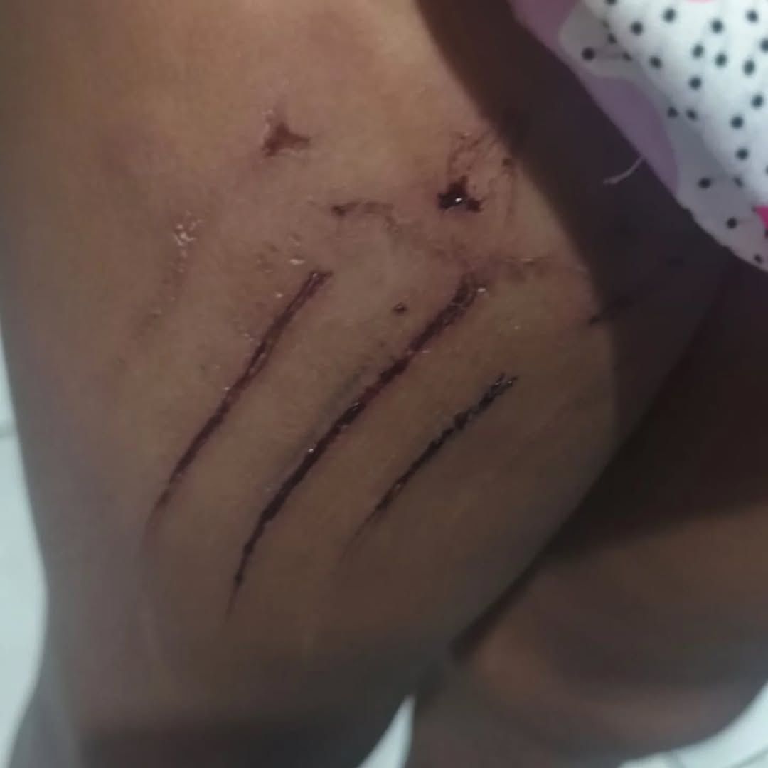 acidente escada rolante, São José dos Campos, Busca Busca, segurança em equipamentos