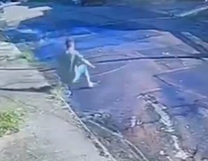 Vítima de choque após queda de poste teve 50% do corpo queimado e segue em estado grave em São José