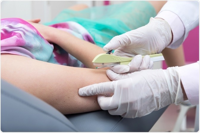 Unidades de saúde de Pindamonhangaba iniciam cadastro para implante contraceptivo gratuito