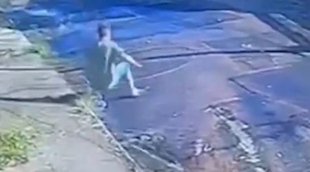 Vítima de choque após queda de poste teve 50% do corpo queimado e segue em estado grave em São José