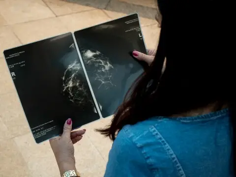 Programa Empresa Amiga da Saúde da Mulher quer estimular mamografias