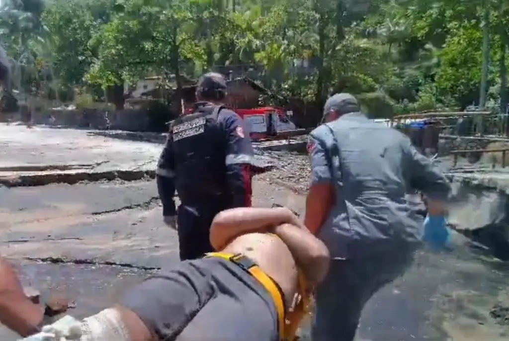 Banhista cai e quebra a perna na praia do Veloso, em Ilhabela