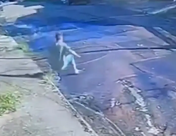 Vítima de choque após queda de poste teve 50% do corpo queimado e segue em estado grave em São José